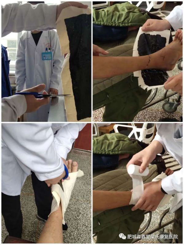梁氏膏药的正确使用方法
